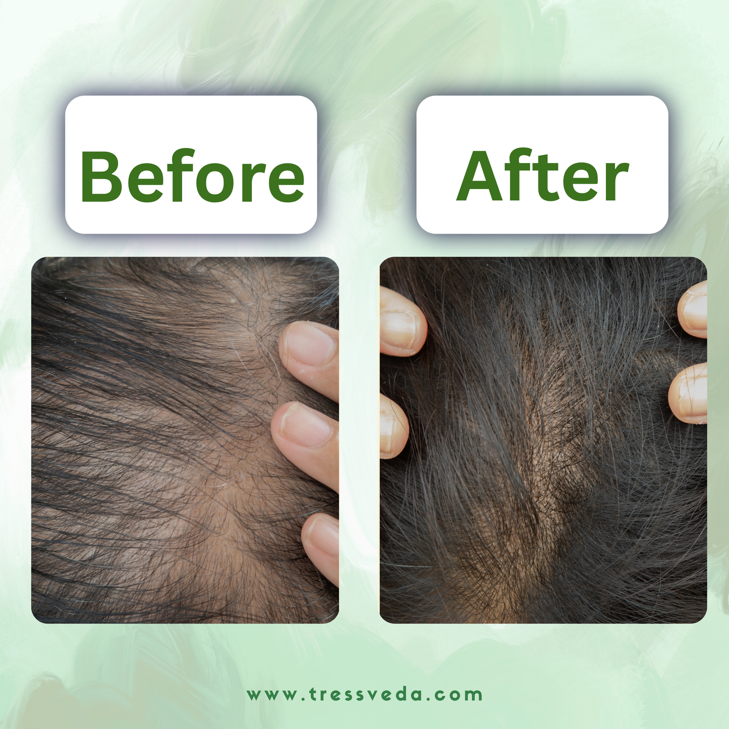 Grow Auraa Hair Oil